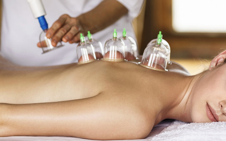 Thérapie par ventouses (cupping)